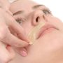female mustache depilation